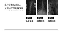 以植观洗发水的功效及使用方法详解（让你拥有健康秀发的秘密）